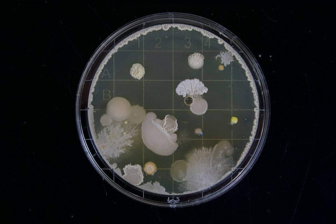 Microscopic view of bacterial samples showing the tiny organisms present in spore syringes for mushroom cultivation